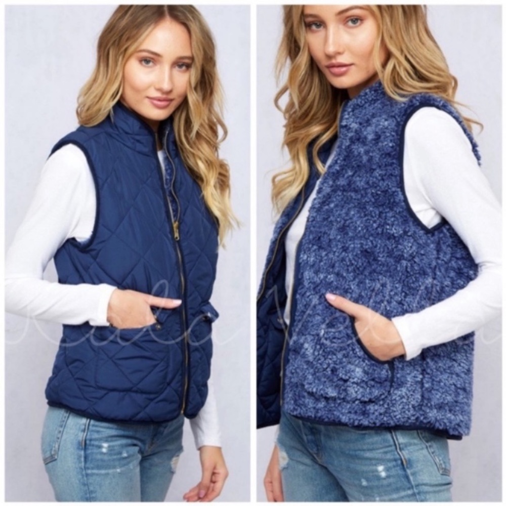 Navy Faux Fur Reversible Vests